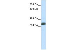 WB Suggested Anti-SAP30BP Antibody Titration:  0. (SAP30BP Antikörper  (C-Term))