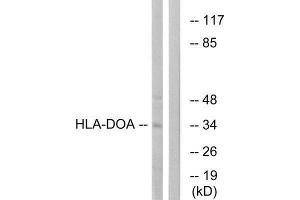 Western Blotting (WB) image for anti-HLA Class II DO alpha (HLA-DOA) (Internal Region) antibody (ABIN1851438)