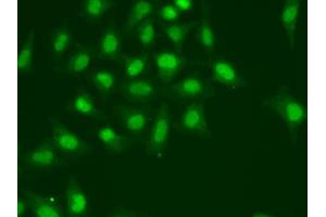 Immunofluorescence analysis of A549 cells using POLD1 antibody. (POLD1 Antikörper)