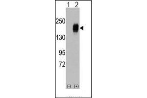 Western blot analysis of EGFR (arrow) using rabbit polyclonal EGFR Antibody. (EGFR Antikörper  (Tyr987))