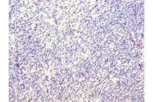 Immunohistochemistry of paraffin-embedded human thymus tissue using ABIN7171361 at dilution of 1:100 (TRIM Antikörper  (AA 29-186))