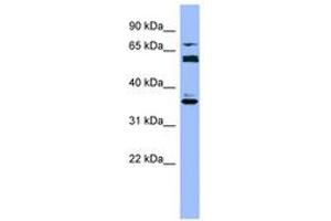 Image no. 1 for anti-Cytochrome P450, Family 2, Subfamily B, Polypeptide 6 (CYP2B6) (AA 215-264) antibody (ABIN6749723) (CYP2B6 Antikörper  (AA 215-264))