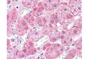 Immunohistochemistry (IHC) image for anti-Mitogen-Activated Protein Kinase Kinase 2 (MAP2K2) (N-Term) antibody (ABIN2783572) (MEK2 Antikörper  (N-Term))