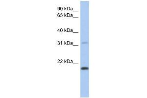 WB Suggested Anti-CLECL1 Antibody Titration: 0. (CLECL1 Antikörper  (Middle Region))