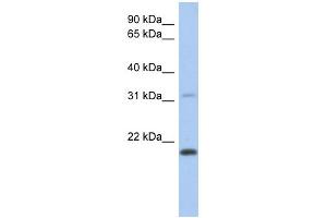WB Suggested Anti-CLECL1 Antibody Titration: 0.