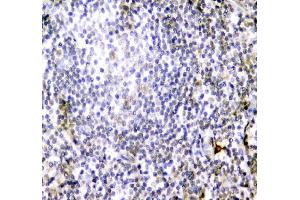 IHC analysis of CD84 using anti-CD84 antibody (ABIN6719602). (CD84 Antikörper  (AA 22-225))