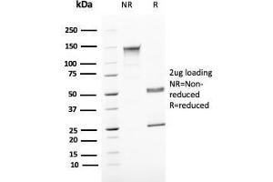 SDS-PAGE Analyis Purified Uroplakin 1B Mouse Monoclonal Antibody (UPK1B/3081). (Uroplakin 1B Antikörper  (AA 109-229))