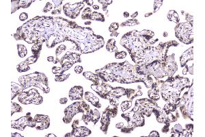 IHC analysis of TCP1 alpha using anti-TCP1 alpha antibody . (TCP1 alpha/CCTA Antikörper  (C-Term))