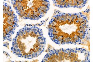 ABIN6260461 and ABIN6276363 at 1/100 staining Mouse testis tissue by IHC-P. (CARD8 Antikörper  (Internal Region))