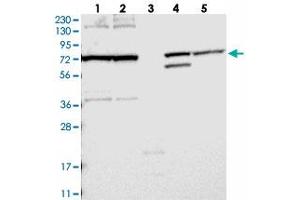 Western blot analysis of Lane 1: RT-4, Lane 2: U-251 MG, Lane 3: Human Plasma, Lane 4: Liver, Lane 5: Tonsil with FAM161B polyclonal antibody  at 1:250-1:500 dilution.