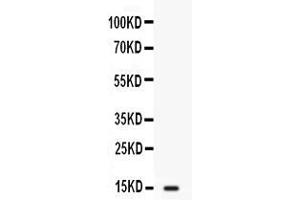 Western blot analysis of FABP2/I-FABP expression in SW620 whole cell lysates ( Lane 1). (FABP2 Antikörper  (N-Term))