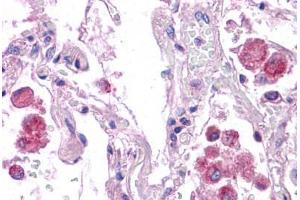 Immunohistochemistry (Formalin-fixed Paraffin-embedded Sections) (IHC (fp)) image for anti-HNF1 Homeobox A (HNF1A) (AA 179-228) antibody (ABIN6745749)