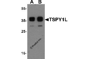 Western Blotting (WB) image for anti-TSPY1L (C-Term) antibody (ABIN1077408) (TSPY1L (C-Term) Antikörper)