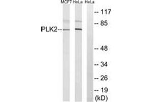 Western blot analysis of extracts from HeLa/MCF-7 cells, using PLK2 Antibody. (PLK2 Antikörper  (AA 291-340))