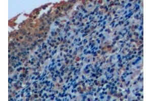 Immunohistochemistry (IHC) image for anti-CD7 (CD7) (AA 26-134) antibody (ABIN7444421)
