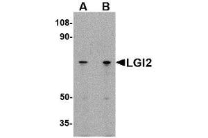 Image no. 1 for anti-Leucine-Rich Repeat LGI Family, Member 2 (LGI2) (N-Term) antibody (ABIN1494389) (LGI2 Antikörper  (N-Term))
