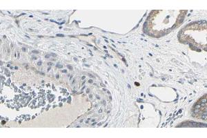 ABIN6269106 at 1/100 staining Human prostate tissue by IHC-P. (EIF4E Antikörper  (C-Term))