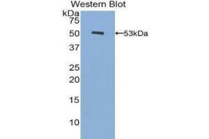 Western Blotting (WB) image for anti-Fibrinogen beta Chain (FGB) (AA 45-491) antibody (ABIN1078031)