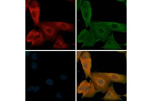 ABIN6256279 and ABIN6267329 staining  cells(H2O2 treatment) by IF/ICC.