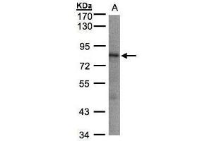Western Blotting (WB) image for anti-LIM Domains Containing 1 (LIMD1) (C-Term) antibody (ABIN2856419)