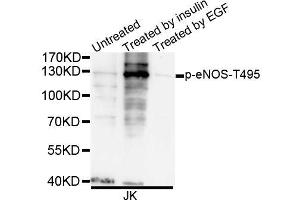 Western blot analysis of extracts of JK cells, using Phospho-eNOS-T495 antibody (ABIN5995598). (ENOS Antikörper  (pTyr495))