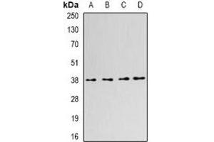 Western blot analysis of SLM-1 expression in Hela (A), K562 (B), MCF7 (C), NIH3T3 (D) whole cell lysates.