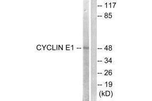 Western blot analysis of extracts from HeLa cells, treated with Paclitasel (1uM, 60 mins), using Cyclin E1 (Ab-395) antibody.
