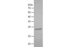 Western Blotting (WB) image for Interleukin-1 Receptor-Associated Kinase 3 (IRAK3) (AA 428-596) protein (His tag) (ABIN7123628) (IRAK3 Protein (AA 428-596) (His tag))