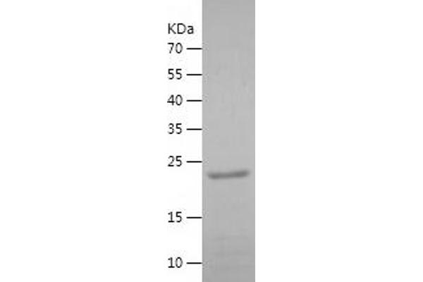 IRAK3 Protein (AA 428-596) (His tag)