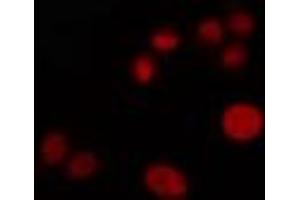 ABIN6274277 staining HuvEc cells by IF/ICC. (ZNF75 Antikörper  (Internal Region))