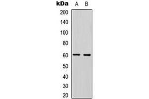 Western blot analysis of PDCD4 (pS457) expression in HeLa (A), Jurkat (B) whole cell lysates. (PDCD4 Antikörper  (C-Term, pSer457))