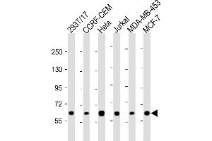 RNF31 antibody  (C-Term)