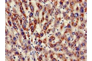 Immunohistochemistry of paraffin-embedded human liver tissue using ABIN7157524 at dilution of 1:100 (KIR3DL1 Antikörper  (AA 81-336))