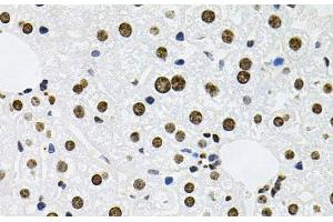Immunohistochemistry of paraffin-embedded Mouse liver using MCL1 Polyclonal Antibody at dilution of 1:100 (40x lens). (MCL-1 Antikörper)