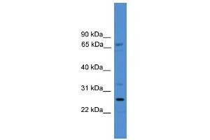 WB Suggested Anti-SLC13A3 Antibody Titration:  0. (SLC13A3 Antikörper  (C-Term))