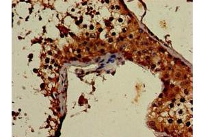 Immunohistochemistry of paraffin-embedded human testis tissue using ABIN7149026 at dilution of 1:100