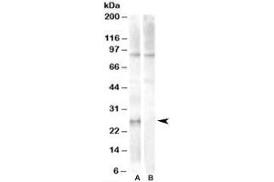 Western blot testing of human heart lysate with APOBEC2 antibody at 1ug/ml with [B] and without [A] blocking peptide. (APOBEC2 Antikörper)
