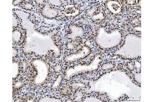 IHC analysis of RCC1 using anti-RCC1 antibody (ABIN7600022).
