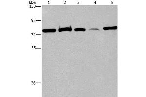 Western Blot analysis of 293T cell, Human fetal brain tissue and K562 cell, Human fetal liver tissue and Hela cell using ACVR2A Polyclonal Antibody at dilution of 1:400 (ACVR2A Antikörper)