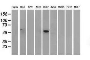 Image no. 2 for anti-Tumor Protein P53 (TP53) antibody (ABIN1499976) (p53 Antikörper)