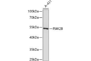 Western blot analysis of extracts of A-431 cells, using PI4K2B antibody (ABIN7269285) at 1:1000 dilution.