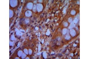 Immunohistochemistry (IHC) image for anti-Chromodomain Helicase DNA Binding Protein 3 (CHD3) antibody (ABIN2983311) (CHD3 Antikörper)