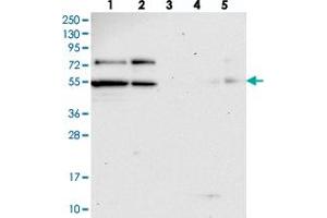 Western blot analysis of Lane 1: RT-4, Lane 2: U-251 MG, Lane 3: Human Plasma, Lane 4: Liver, Lane 5: Tonsil with KANSL2 polyclonal antibody .