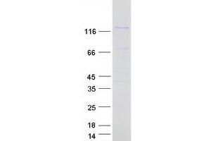 PPP6R3 Protein (Transcript Variant 4) (Myc-DYKDDDDK Tag)
