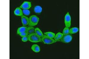 IF analysis of Cofilin using anti-Cofilin antibody (ABIN3042746). (Cofilin Antikörper  (C-Term))