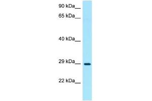 WB Suggested Anti-TNIP3 Antibody Titration: 1. (TNIP3 Antikörper  (N-Term))