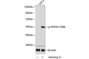 Western blot analysis of extracts from HeLa cells using Phospho-HNF4A(S304) Polyclonal Antibody. (HNF4A Antikörper  (pSer304))