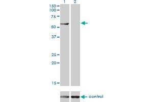 Western blot analysis of CESK1 over-expressed 293 cell line, cotransfected with CESK1 Validated Chimera RNAi (Lane 2) or non-transfected control (Lane 1).