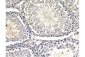ABIN7096496 and ABIN7100560 at 1/100 staining rat testis tissue by IHC-P.