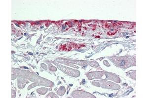 Immunohistochemistry (IHC) image for anti-Periostin (POSTN) (Middle Region) antibody (ABIN405413) (Periostin Antikörper  (Middle Region))